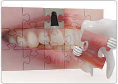 歯周病の原因と進行について